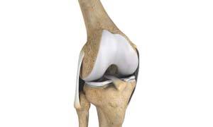 Multi-ligament Instability